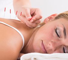 Acupuncture Help