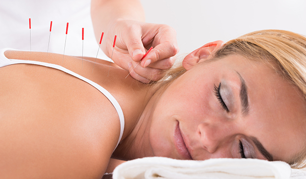 Acupuncture Help